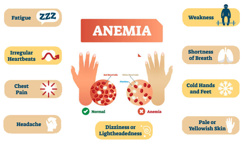 Anemia y perdida de peso