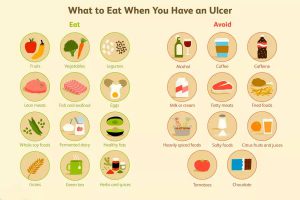 Diet for Stomach ulcers 1 300x200 - Diet for Stomach ulcer: Causes, symptoms, treatment